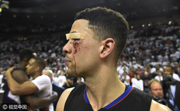 今夜葡萄牙体育备战NBA季后赛；内部沟通细节曝光；话题不断；医务组通报恢复的简单介绍